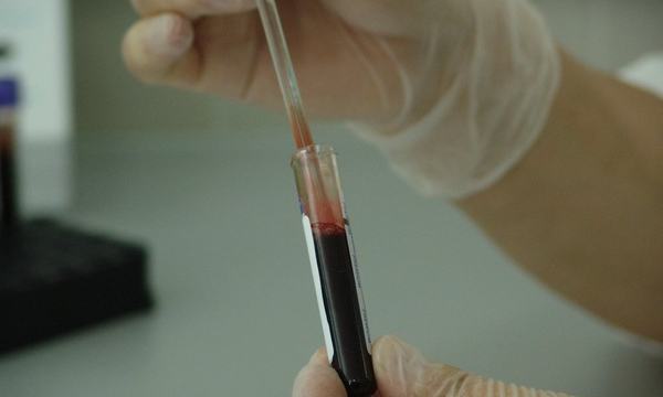 Gloved hand holding a blood sample tube